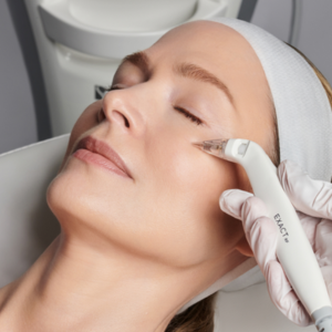 A woman had a Exact RF on her face.