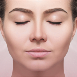 Exosomes Treatments under injectables