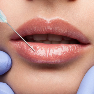 Restylane
