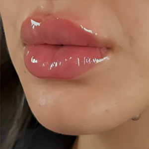 after inject pic. 1