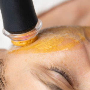 Glo2Facial at Trinity Med Spa