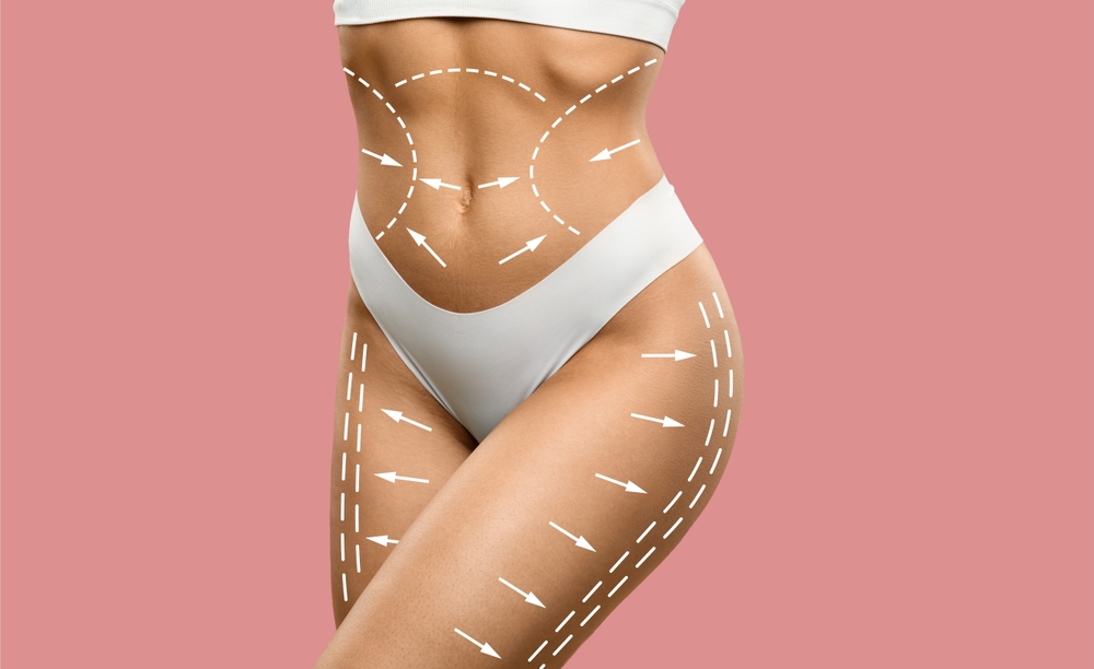 T-Shape body sculpting