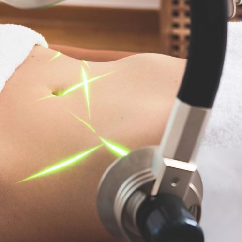 LOW-LEVEL LASER THERAPY LOW-LEVEL LASER THERAPY