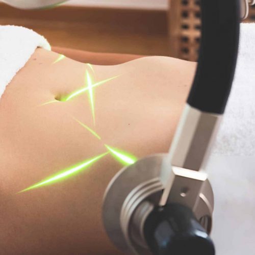 LOW-LEVEL LASER THERAPY